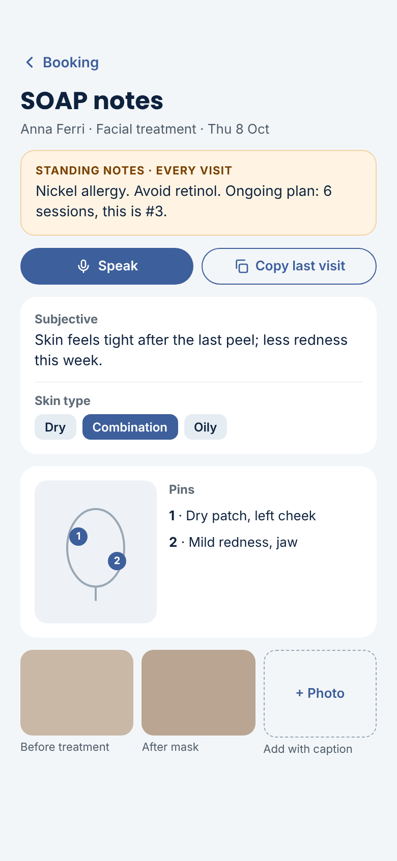 Salon Booking System Mobile Web App — SOAP Notes add-on: treatment notes with pins and photos